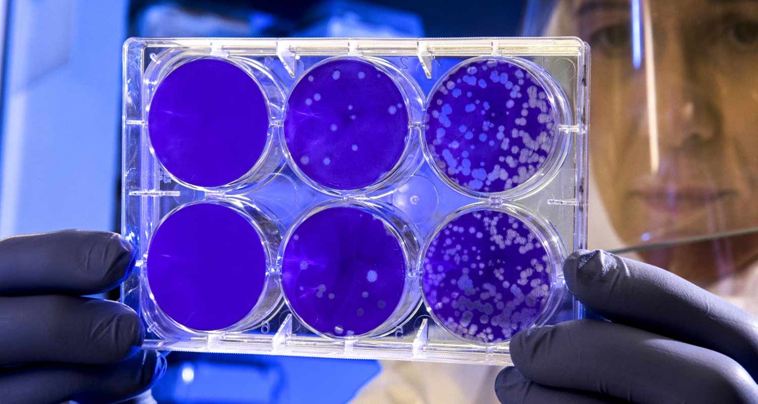 Monkeypox, il vaiolo delle scimmie non sarà una pandemia