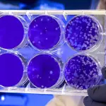 Monkeypox, il vaiolo delle scimmie non sarà una pandemia